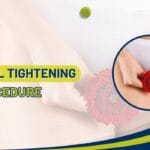 vaginal tightening procedure