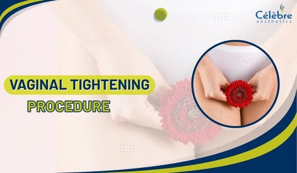 vaginal tightening procedure