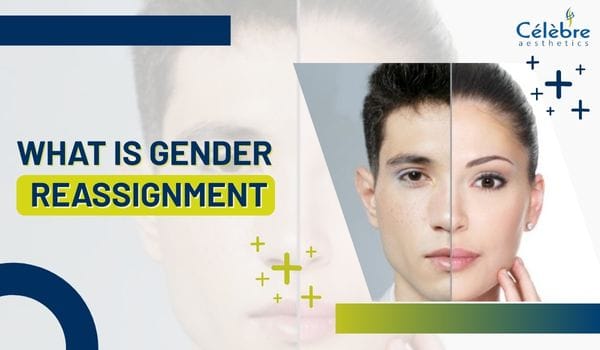 Gender Reassignment Surgery